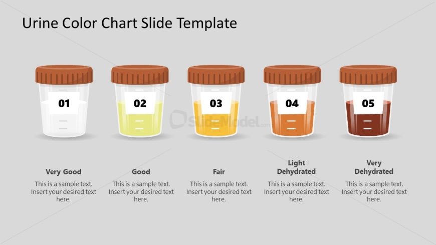 Urine Color Chart Presentation Slide 