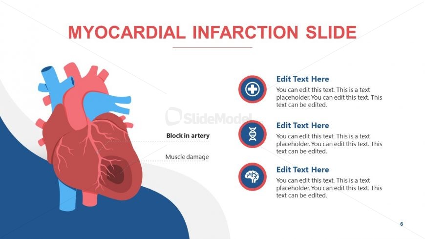 PowerPoint Diagram for Human Heart Myocardial Infarction 