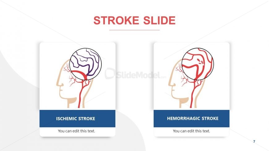 Medical Template for Stroke Types 